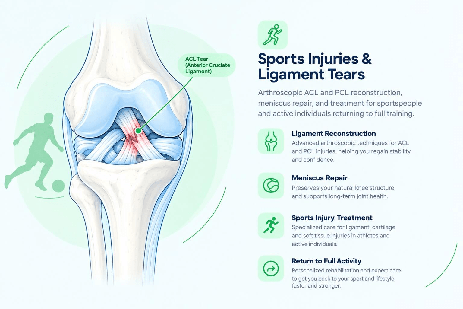 Illustration of a torn knee ligament in an active sportsperson